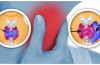 Tiroide: quando il pericolo si trova in casa