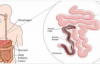 Il rimedio naturale per ammazzare i parassiti che vivono nel tuo corpo