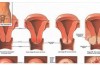 ATTEZIONE: Segni e Sintomi Del Cancro Proprio lì…. Non Sottovalutateli, Potrebbero Essere fatali